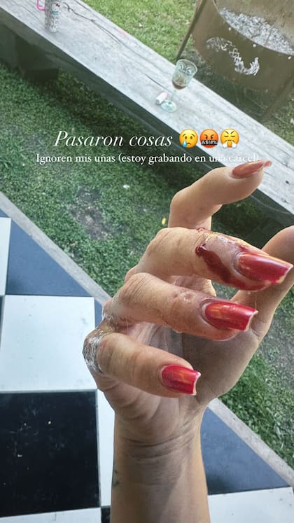 La China Suárez tuvo un accidente doméstico en su jardín (Foto: captura/Instagram/@sangrejaponesa)