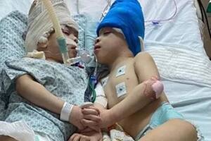 La cirugía se realizó en Río de Janeiro