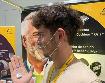 La colocación del implante de conducción ósea significó un antes y un después en la vida Lucas.