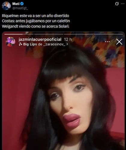 La comparación de Weigandt llegó hasta los labios de "La Cuerpo"