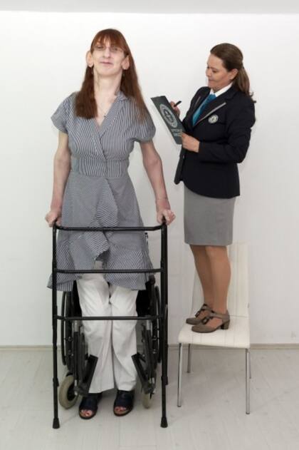 La condición también trae consigo serias discapacidades físicas como la escoliosis, falta de musculatura y problemas de equilibrio