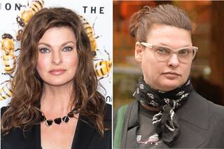 El gran problema tras la “brutal deformación” de la modelo Linda Evangelista