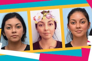 Dismorfia de Snapchat: cirugías para parecerse a los filtros de las selfies