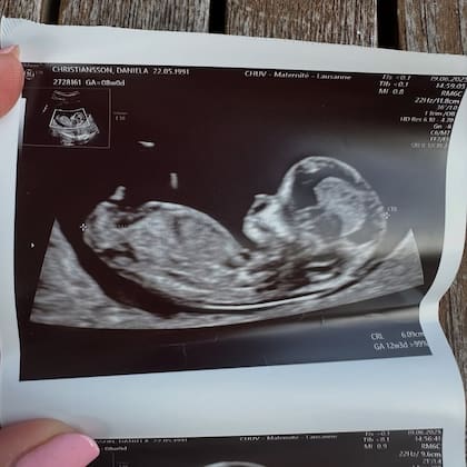 La empresaria mostró la ecografía del bebé; según reveló, está de trece semanas (Foto: Instagram @danielachristiansson)