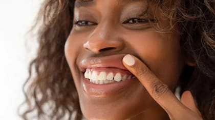 La enfermedad de las encías, también conocida como periodontitis, es una afección grave