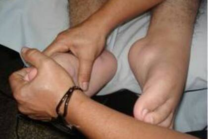 La enfermedad de Pompe genera distrofia muscular