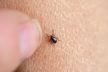 La enfermedad es transmitida por garrapatas