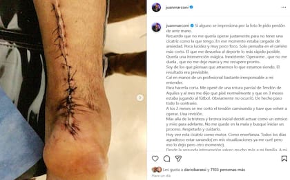 La enorme cicatriz en su pierna causó sorpresa en sus seguidores de las redes sociales