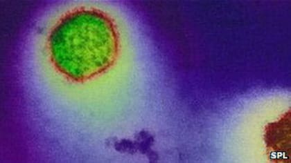 Los estudios de laboratorio ratificaron la presencia del virus en el organismo de la paciente