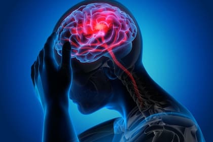 La epilepsia es un trastorno neurológico crónico caracterizado por una actividad eléctrica anormal en el cerebro