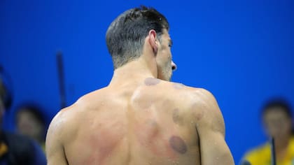 La espalda de Phelps