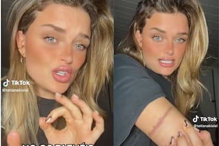 Una modelo decidió borrar 20 tatuajes de su cuerpo y generó un enorme debate en TikTok
