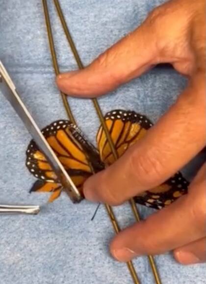 La especialista retiró la sección doblada de la extremidad dañada, alineó las venas negras de la zona afectada con las del donante y fijó la pieza con cemento de contacto