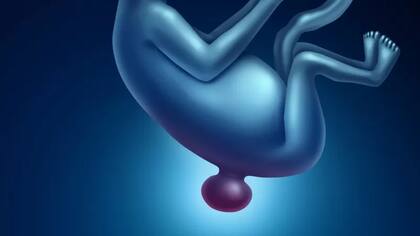 La espina bífida puede variar de leve a grave, según el tipo de defecto, el tamaño, la ubicación y las complicaciones