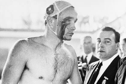 La estrella húngara del waterpolo, Ervin Zador, tras las peleas en los Juegos de Melbourne, en 1956