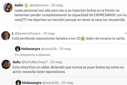 La ex Casi Ángeles recibió críticas de todo tipo a raíz de la polémica sobre si se inyectó o no ácido hialurónico y bótox