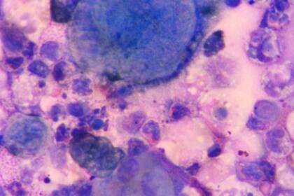 La fagoterapia utiliza virus tratar infecciones bacterianas