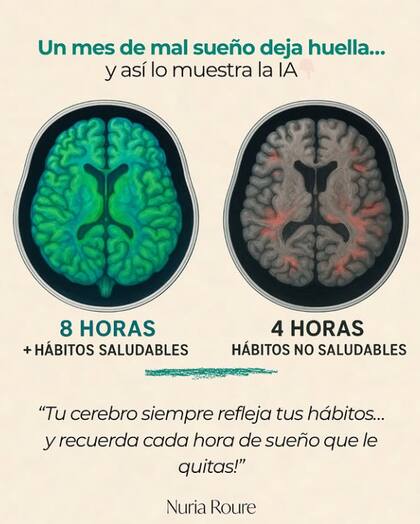 La falta de sueño tiene consecuencias en la actividad cerebral (Foto: @dra.nuriaroure)