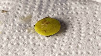 La ficha que estaba alojada en su nariz y que le provocaba respirar con dificultad