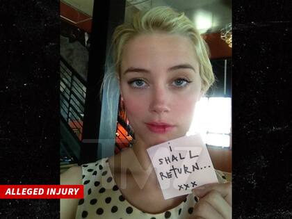 La foto de Amber Heard con el labio roto y ensangrentado que publicó el medio estadounidense (Foto: TMZ)