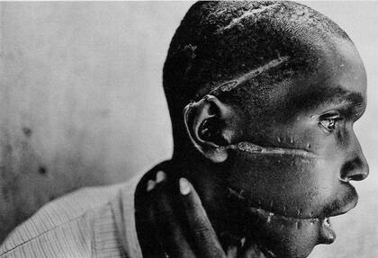 La foto de James Nachtwey ganó el World Press en 1995