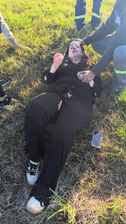 La foto de Rocío Bonacci tras el accidente