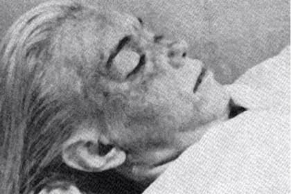 La foto del cadáver de Marilyn que fue difundida pocos días después de su muerte también forma parte del documental