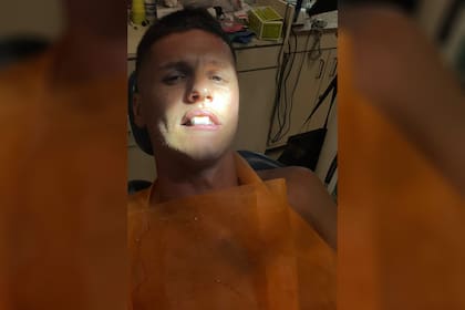 La foto que compartió Guido Carrillo en el dentista, luego de perder tres dientes en el Estudiantes vs. Sarmiento