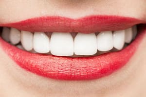 La genética puede influir en el blanco de tus dientes.