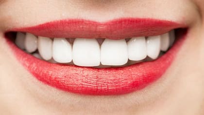 La genética puede influir en el blanco de tus dientes.