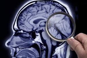 La Ciencia descubrió qué genera en el cerebro y qué efectos tiene en la salud