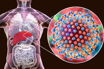 La nueva variante de hepatitis todavía no logra se descifrada por los científicos