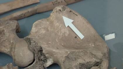 La herida por mordedura se confirmó comparándola con muestras de mordeduras de un león en un zoológico