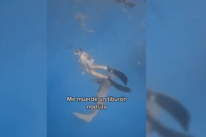 La herida que tuvo el joven no fue de gravedad (Captura video)
