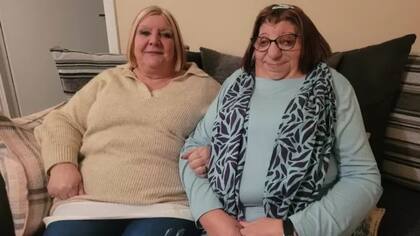 La hermana Jackie (izquierda) dice que Janet siempre se cubría antes de someterse a la cirugía para colocarle prótesis de orejas