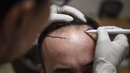 La IA a veces recopila información que distribuyen cuentas de contenido patrocinado