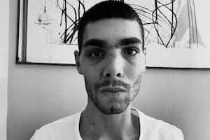 El ciclista italiano que pasó dos semanas en coma y atravesó una reconstrucción facial