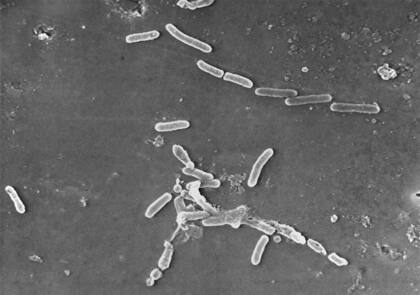 La imagen muestra la bacteria Pseudomonas aeruginosa en forma de bastón (Janice Haney Carr/CDC vía AP, Archivo)