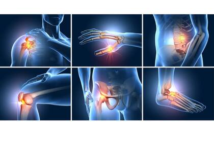 La imagen muestra las principales articulaciones del cuerpo que suelen verse afectadas por la artrosis