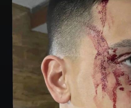 La imagen que subió Sandez a su Instagram, con su rostro ensangrentado