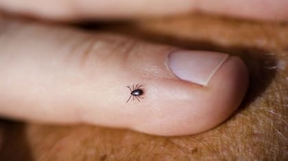 La infección es transmitida por la picadura de una garrapata que tiene la bacteria en forma de espiral llamada Borrelia Burgdorferi