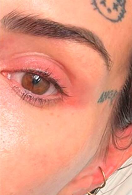 La influencer compartió en sus redes la reacción que le produjo un medicamento recomendado para la caída del cabello