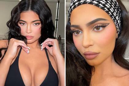 La influencer Kylie Jenner fue una de las celebridades que se animó al baby botox.