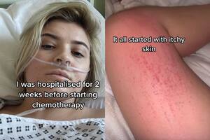 La influencer logró sobrevivir a una difícil situación, luego de creer que era una simple alergia