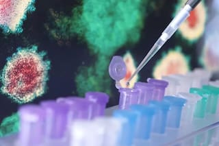 Patentes: la deuda pendiente de la Argentina