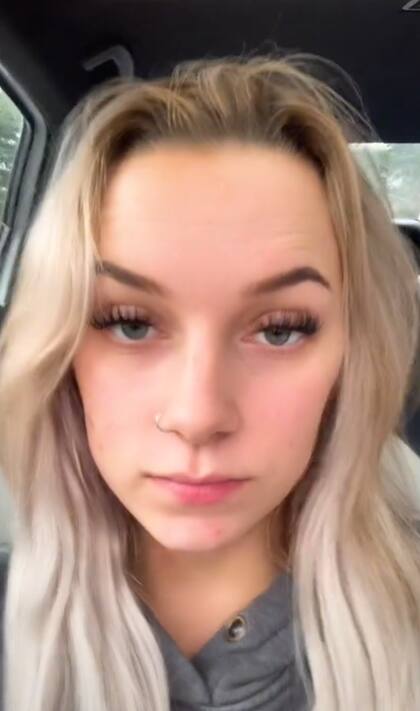 La joven compartió su dolorosa experiencia en TikTok
