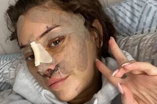 Por qué cada vez hay más jóvenes que recurren a la cirugía plástica