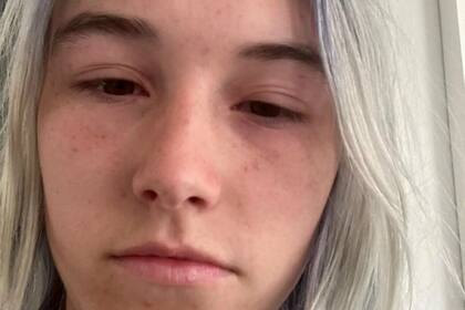 La joven mostró cómo el agua afecta sus ojos y piel al contacto