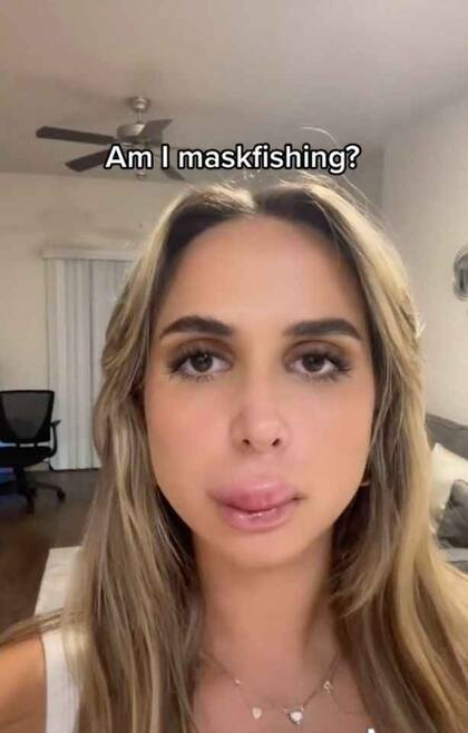 La joven mostró cómo quedaron sus labios post intervención. Fuente: TikTok