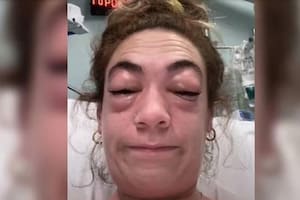 La joven mostró la impactante reacción que tuvo en sus ojos. Fuente: TikTok